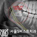 서울에스(S)퍼스트치과의원 이미지