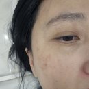 토탈뷰티삽