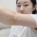 B3 | Y존 착색 크림 추천 지노큐어 인텐시브 B3 미백크림 후기