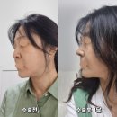 아우어성형외과의원 이미지