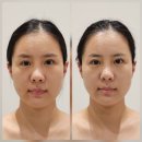 장에스테틱 | 안산 고잔동 윤곽관리 신부관리 추천 ‘안산 온기 에스테틱‘ 후기