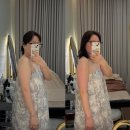 미핏 | 다산 피부관리 미올뷰티 티리온X 말라핏 팔뚝 관리 리얼 후기