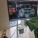 라온치과의원 | 영주라온치과 30대 첫 임플란트 발치 + 식립 후기