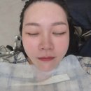 경상남도 창원 헤어라인 관리 톡스앤필브로우 창원점 헤어라인 후기
