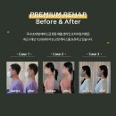 이상훈이비인후과 - 수원시 권선구 매송고색로 667 | 승모근 통증 원인과 해결방법(실제 후기)