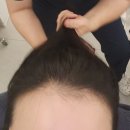 영종태평양약국 | 영종도 하늘도시 탈모 두피 관리점 :: 셀비오 두피 탈모관리