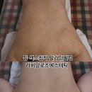 라비앙사우나 | 동대문구 알라딘필링 등 색소침착 개선 리얼 후기