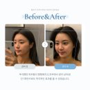 세븐일레븐서구가정베르힐점 | 루원시티 피부관리 LDM 솔에스테틱 인천가정점