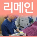 튼살치료비용 얼마정도 들까? 이미지