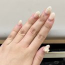 울산 물어뜯는 손톱 : 제시네일에서 교정 성공 후기 ෆ