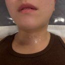 광주피부관리에스코테라피 | 광주 피부관리샵 유목민 정착 추천 '에스코테라피' n번째 내돈내산 방문 후기