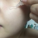 케이힐리테라피 | 노화예방 홈케어 스킨케어 안티에이징 k힐리테라피 힐리스 엑소우라 시카좀 앰플