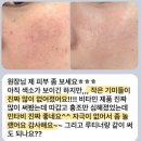 나티나 | 40대 무너진 피부장벽, 루틴 설계로 되살린 변화 사례[나티나스킨 홈케어 코칭 사례]