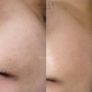 러버블리 이미지