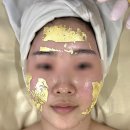 골드웨이브 경북도청점 | 경북도청 피부관리 쎈 턱날려 + 골드셀 관리 후기