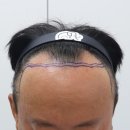 압구정맘모스헤어라인의원 이미지