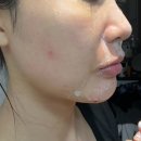 (주)투더베스트 | 오일투폼클렌저 트러블·블랙헤드·건조함까지 한 번에! 리라클 워시겔 솔직 사용 후기