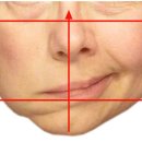 구안와사, 안면 마비, 얼굴 비대칭 예방과 치료 이미지