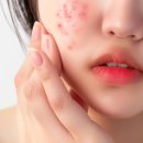 라임 (Lime) 이미지