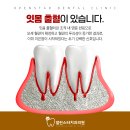 덕신치과 네이버블로그