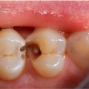 평화맑은신경과의원 | 양평군치과, 과잉진료 걱정되신다구요?