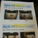 아이노스피부 네이버블로그