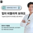 통도한의원 | 얼굴비대칭교정 가격 후기, 입꼬리 턱 비대칭 Type2 교정 케이스 설명