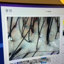 모바이오 - 남동구 성말로 10 | 철산두피관리 모바이오 후기