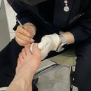 내성발톱, 문제성 손발톱으로 고생하고 있다면 "반디인 하우스 & 큐릭스 광교앨리웨이점"