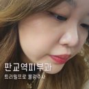 판교역피부과 트리필프로 물광주사로 속건조 잡고 윤곽주사로 관리한 후기