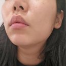 미미피부샵 | 30대 피부 건조·처짐 해결! 미미살롱에서 받고 온 피부 관리 후기