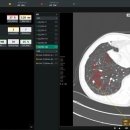 IEC 소프트 이미지