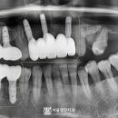 서울좋은치과보철과치과의원 이미지
