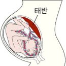 서현부부한의원 이미지