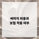 써마지 비용과 보험 적용 여부