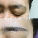 송림헤어라인