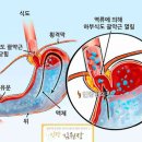 파이토빈
