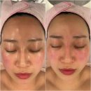 루비나 | 의정부피부관리 솔직 후기 루비나에서