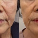 미담케어 이미지