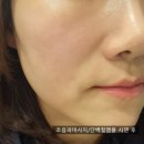 대구동구피부관리 TLS라라샵 아프지않은 울쎄라 가정용 라쎄라 추천_라라코리아탑그룹