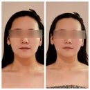 탑온누리약국 | 신대방삼거리 피부관리추천 | “행복에스테틱” 윤곽관리 솔직 후기