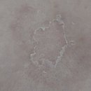 미인헤어샵 | <부천 피부미인> 가슴 여드름 바디 알라딘필로 부천웨딩케어 솔직 후기