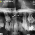 오승훈치과의원 네이버블로그