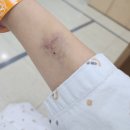 인정병원 | 인정병원 제왕절개 출산 후기