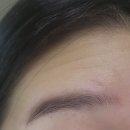 아이비산부인과의원 | 서울 신당동 동묘역 피부과 산부인과 아이비여성의원 - 이마 주름, 미간 주름 보톡스