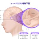 뇌하수체 종양 (선종) 증상 알아보기 이미지