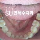 크라운치과기공소 이미지
