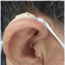 착한보청기 | 강동구보청기 강동구 착한보청기 센터, 난청 고민 해결