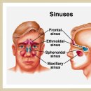 Sinus(부비동) 이미지