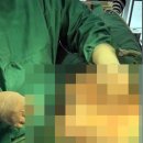 모티바 | 울산 가슴확대, 자연스러운 풀B컵을 원했던 20대 여성의 선택은? 모티바 보형물 상담 후기